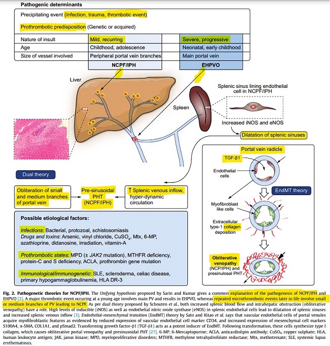 .prehepatalni-etiologie.jpg